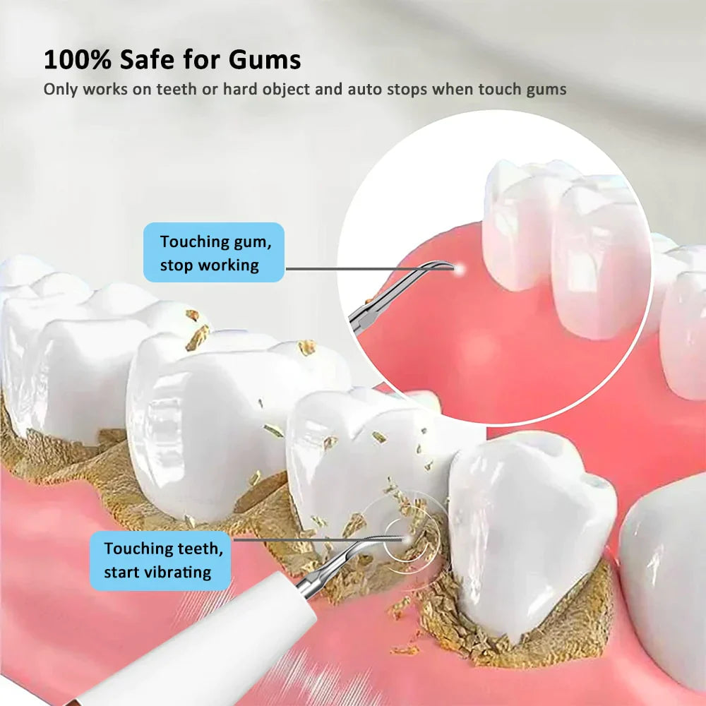 Ultraschall Zahnreiniger für Erwachsene - Effektive Zahnsteinentfernung - Schmerzfreie Anwendung - Hochwertiger Kunststoff-2