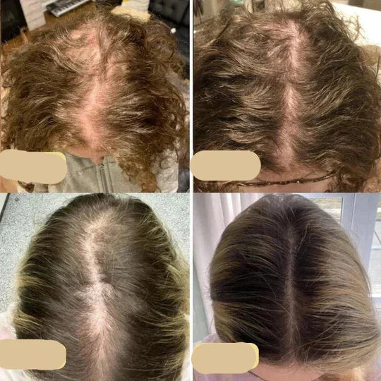 Haarwuchsöl für Frauen und Männer - Natürliche Pflege für Alle Haartypen 4