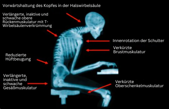 Haltungsbandage für Frauen und Männer mit EMS-Technologie 3