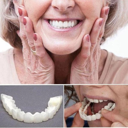 Veneers für ein strahlendes Lächeln - Ober- und Unterkiefer 1